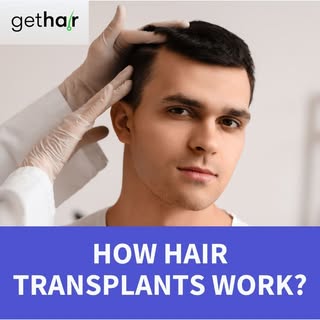 𝗘𝘃𝗲𝗿 𝘄𝗼𝗻𝗱𝗲𝗿𝗲𝗱 𝗵𝗼𝘄 𝗵𝗮𝗶𝗿 𝘁𝗿𝗮𝗻𝘀𝗽𝗹𝗮𝗻𝘁𝘀 𝗮𝗰𝘁𝘂𝗮𝗹𝗹𝘆 𝘄𝗼𝗿𝗸? 🤔 
It’s
