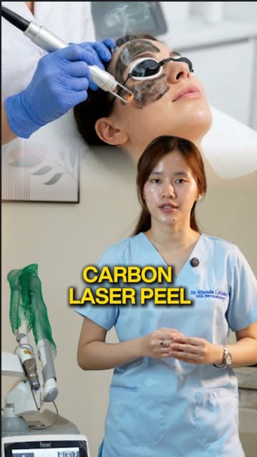 ✨ Carbon Laser Peel – Glow, Refresh & Rejuvenate Your Skin! ✨

Want smoother, brighter-looking skin?