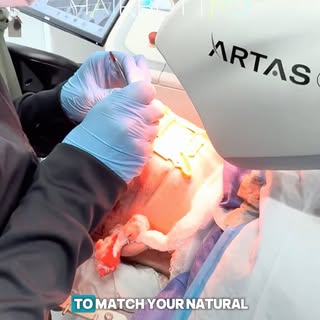 Natural-looking results start with the latest technology. 💇‍♂️✨
At HairBot MD, we use the advanced 