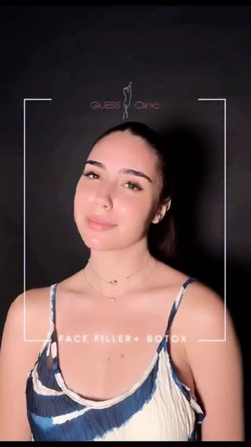 Une touche de fraîcheur, sans changer votre identité ✨

Avec une approche Face Filler + Botox, l’obj