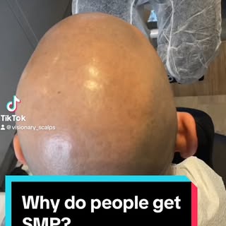 Hair loss effecting your confidence ?

Why do people get SMP?

⬆️ tells you why