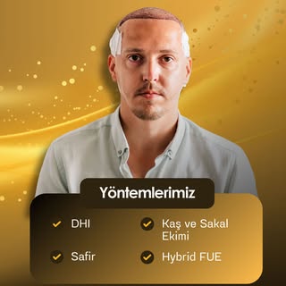 Saç ekimi uygulamalarımızda hedefimiz;
doğal görünüm ve maksimum sıklık hissi oluşturmaktır.

Safir,