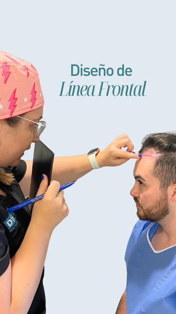 Tu rostro tiene una forma que nadie más tiene. Por eso tu línea frontal tampoco puede ser igual a la