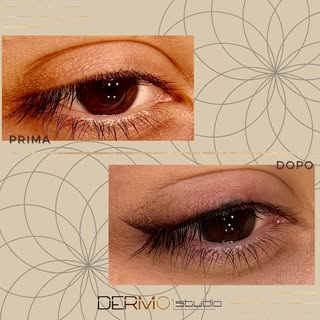#eyeliner #truccopermanente #dermopigmentazione #dermostudiorimini #eyetattoo