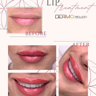Natural lips 💋