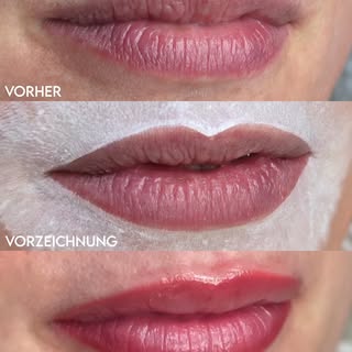 👄 3D LIPPEN VOLUMEN 👄

Du wünscht dir eine dezente Lippen Vergrößerung ohne künstlichen Effekt???
