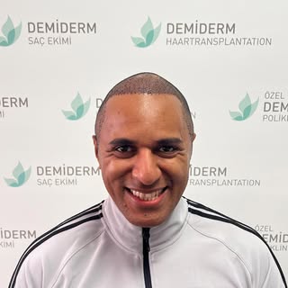 Our valued patient from New Zealand’s hair transplant journey. 😇 #sacekimi #hairtransplant #hair #s