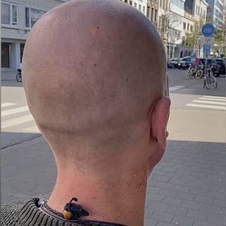 #smp #smpbelgium#scalpmicropigmentation#belgium #scalptattoo