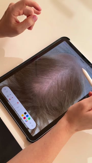 Ver o cabelo voltar a preencher áreas que antes tinham falhas vai muito além da estética. É recupera