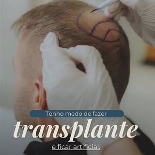 Naturalidade não é sorte, é planejamento. 📐

Muitas pessoas ainda têm o trauma de técnicas antigas 