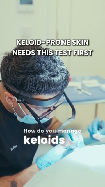 Dr Ditta – Keloid Risk in Hair Transplants

Patients with darker skin tones can have a higher risk o
