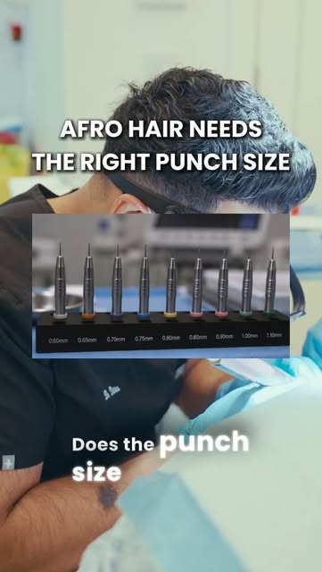 Dr. Ditta – Afro-Caribbean Hair Transplants

Do Afro-Caribbean patients need a larger punch size dur