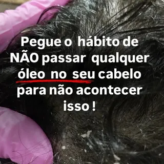 SALVE ESSE POST ANTES DE PASSAR QUALQUER ÓLEO NO CABELO!

Cada cabelo tem uma necessidade diferente,