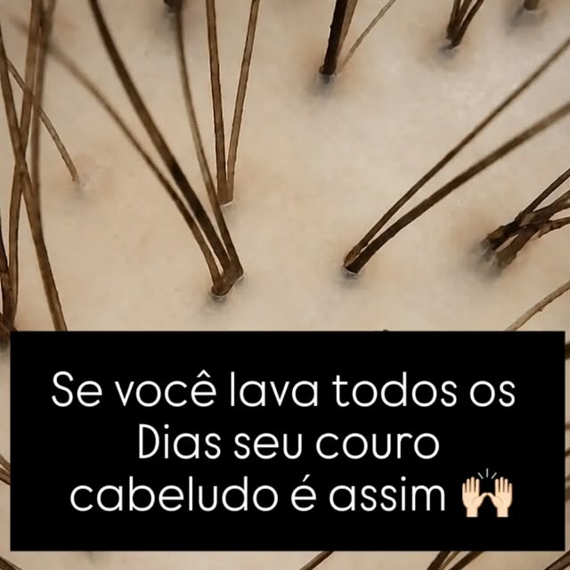 Você ainda acha que lavar o cabelo todos os dias faz ele cair mais? 👀

O problema pode estar justam