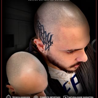Naturalidade ultra realista criando um efeito natural,
simulando densidade e devolvendo auto estima!