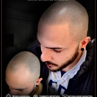 Naturalidade ultra realista criando um efeito natural,
simulando densidade e devolvendo auto estima!