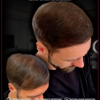 Naturalidade ultra realista criando um efeito natural,
simulando densidade e devolvendo auto estima!