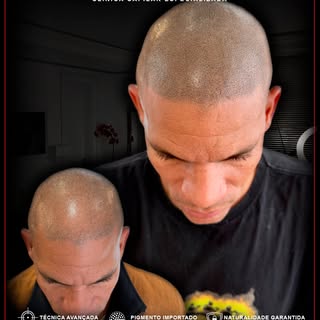Naturalidade ultra realista criando um efeito natural,
simulando densidade e devolvendo auto estima!