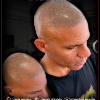 Naturalidade ultra realista criando um efeito natural,
simulando densidade e devolvendo auto estima!