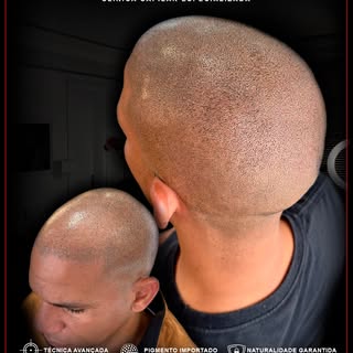 Naturalidade ultra realista criando um efeito natural,
simulando densidade e devolvendo auto estima!