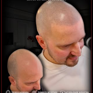 Naturalidade ultra realista criando um efeito natural,
simulando densidade e devolvendo auto estima!