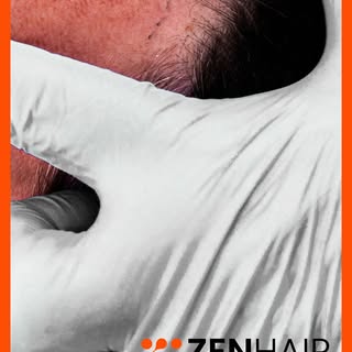 Growing Confidence, Naturally.

www.zenhairtransplant.com

#zenhair #zenhairtransplant
#HairTranspla