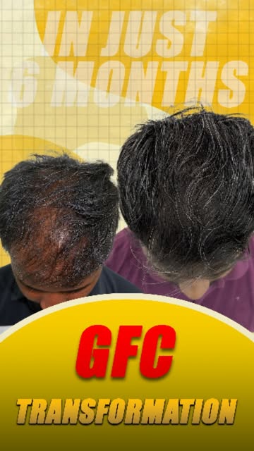 GFC Hair Treatment Result — Real Hair Growth? 🔥

For appointments call/ whatsapp: +91 98345 12885.
