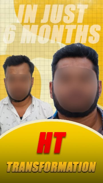 The BEFORE made him worry. The AFTER changed the picture. 😱🔥

For appointments call/ whatsapp: +91