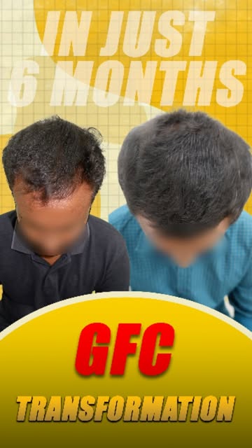 Hair thinning to visible transformation? 👀🔥

For appointments call/ whatsapp: +91 98345 12885.
Cli