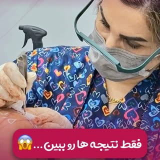 ⁨	⁨	⁨	⁨	بعضی نتیجه‌ها فقط «تغییر» نیستن✌🏻
شروعِ یک حس خوبِ تازه‌ان…🌱
وقتی انتخاب درست، دقت و تخصص 