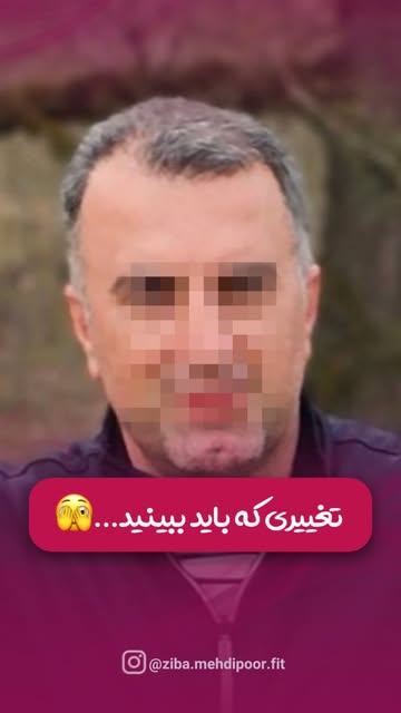 ⁨	تراکم واقعی، نتیجه‌ی کار اصولی و اجرای دقیق✌🏻😍

این نتیجه، حاصل دقت در جزئیاته🤌🏻
برای موهایی ب