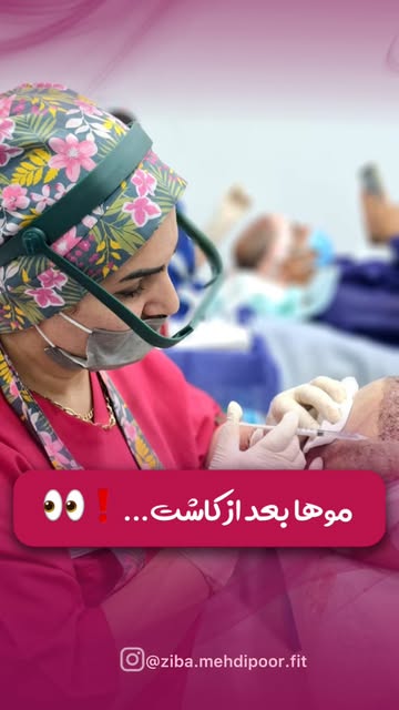 ⁨	⁨	⁨	زمان و سرعت رشد در هر فرد می تواند متفاوت باشد🤌🏻
و عواملی مانند شرایط ژنتیکی،کیفیت بانک مو و