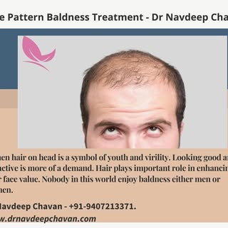 In men hair on the head is a symbol of youth and virility. Looking good and attractive is more of a 