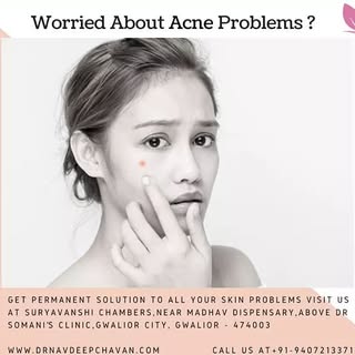 Find permanent solution Acne Problems...!
Visit at www.drnavdeepchava.com
#SkinLighting  #Skinbright
