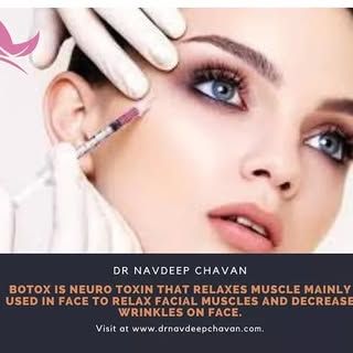 Botox is a neurotoxin that relaxes muscle mainly used in face to relax facial muscles and decrease w