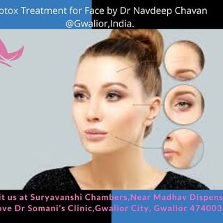 Botox treatment for face by Dr Navdeep Chavan Gwalior, India.
More info visit at - www.drnavdeepchav