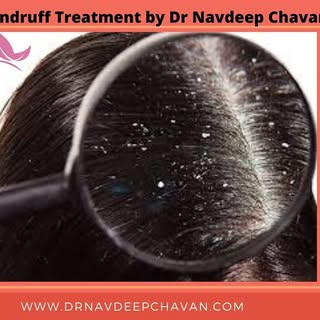 Hair Loss and Hair Dandruff Problem..?
Get Best treatment for Hair problems..
Visit at www.drnavdeep