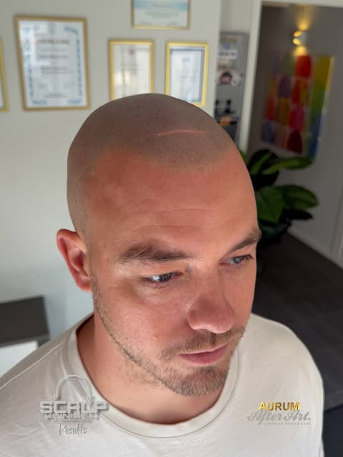 BEFORE AND AFTER RESULTS💨

NATURAL SMP🫵🏽

#smp #natural #skills #tattoos