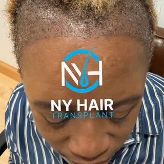 Every hair restoration journey begins with a personalized plan.

Hair restoration for textured hair 
