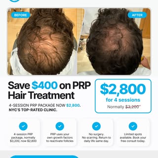 Save $400 on PRP Hair Treatment.

PRP (Platelet-Rich Plasma) therapy uses your body’s own growth fac