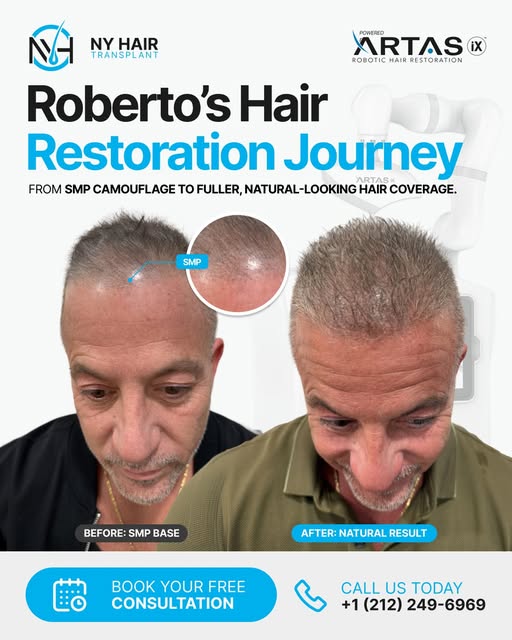 From SMP camouflage to natural-looking hair restoration.

Scalp micropigmentation can help create th