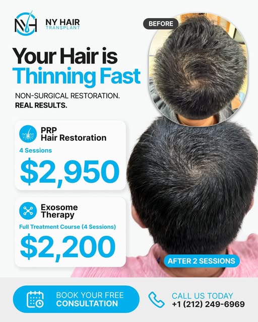 Thinning hair? You have non-surgical options.

PRP Hair Restoration and Exosome Therapy are designed