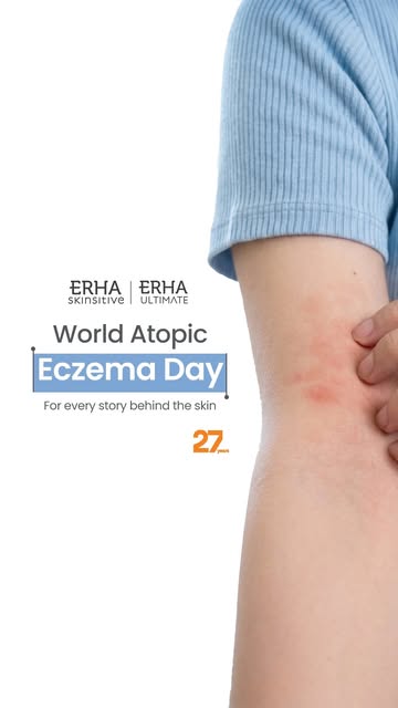 Eczema bukan hanya tentang apa yang terlihat di kulit.

Di balik kulit yang kering, gatal, dan kemer