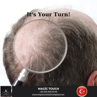 It's your turn to get the hair you dream of!

Hair transplantation is not just an operation. Hair tr