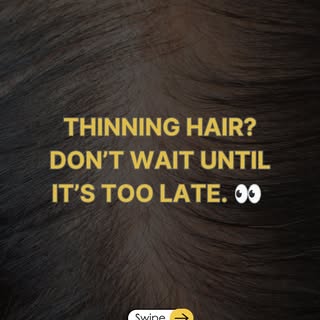 𝗛𝗮𝗶𝗿 𝗹𝗼𝘀𝘀 𝗶𝘀𝗻’𝘁 𝗷𝘂𝘀𝘁 𝗮𝗯𝗼𝘂𝘁 𝗵𝗮𝗶𝗿.

For many people, watching their hair beco