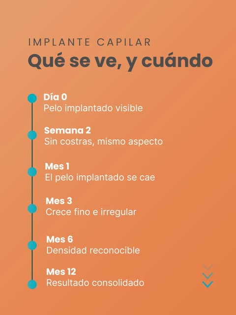 El mes 1 es el que descoloca, y conviene saberlo antes de que pase.

Alrededor de las cuatro semanas