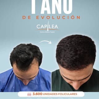 Como día Martes dando de alta un nuevo caso con un resultado de 1 año. 💚

Estas entradas hoy lucen 