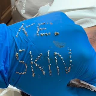 When the extractions are so satisfying… they start spelling the brand. 😅
KE SKIN😎