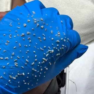 Watch to see what comes out 🫣

The magic of our deep clean, removing all the dirt and dead skin fro
