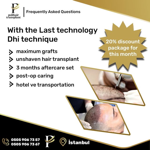 With the Last technology Dhi technique 
- maximum grafts
- unshaven hair transplant
- 3 months after
